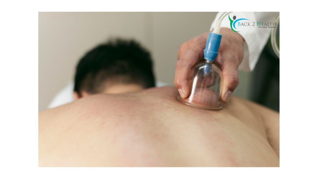 cupping therapy in Brownstown