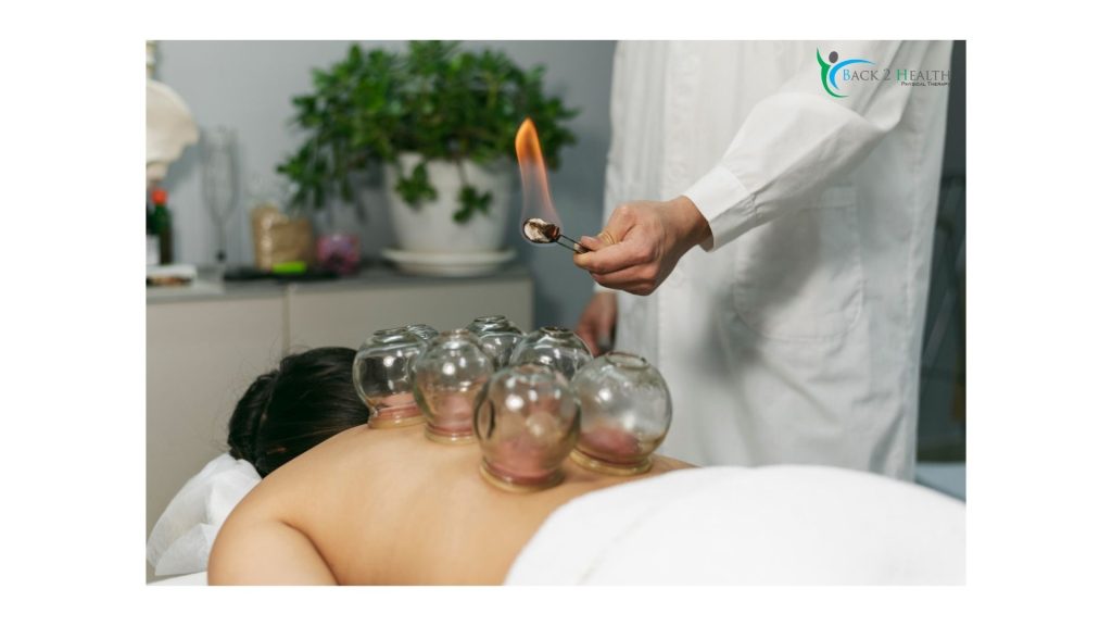 Cupping Therapy in Brownstown