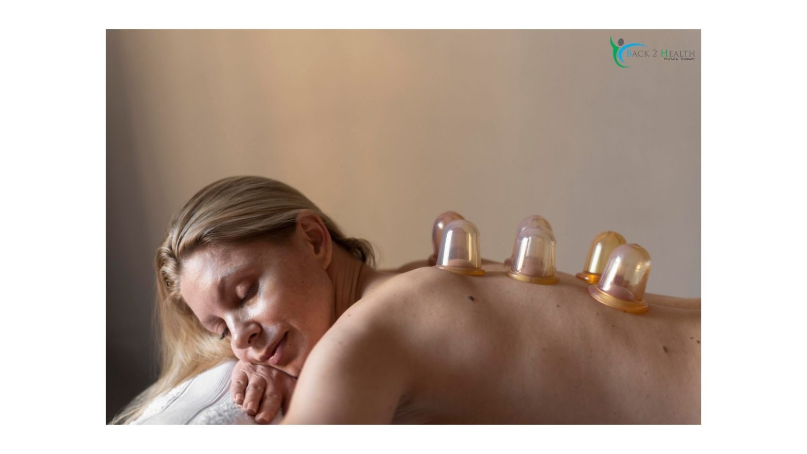 A patient receiving professional myofascial decompression treatment from a cupping specialist Brownstown at Back 2 Health to relieve muscle tension and improve circulation.