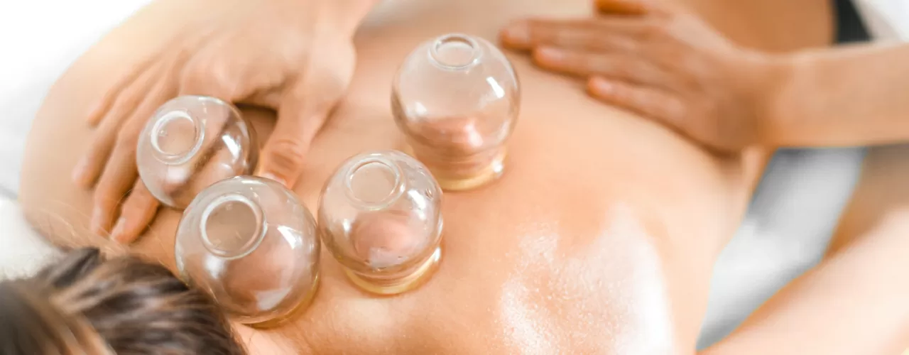 Cupping Sterling Heights, MI