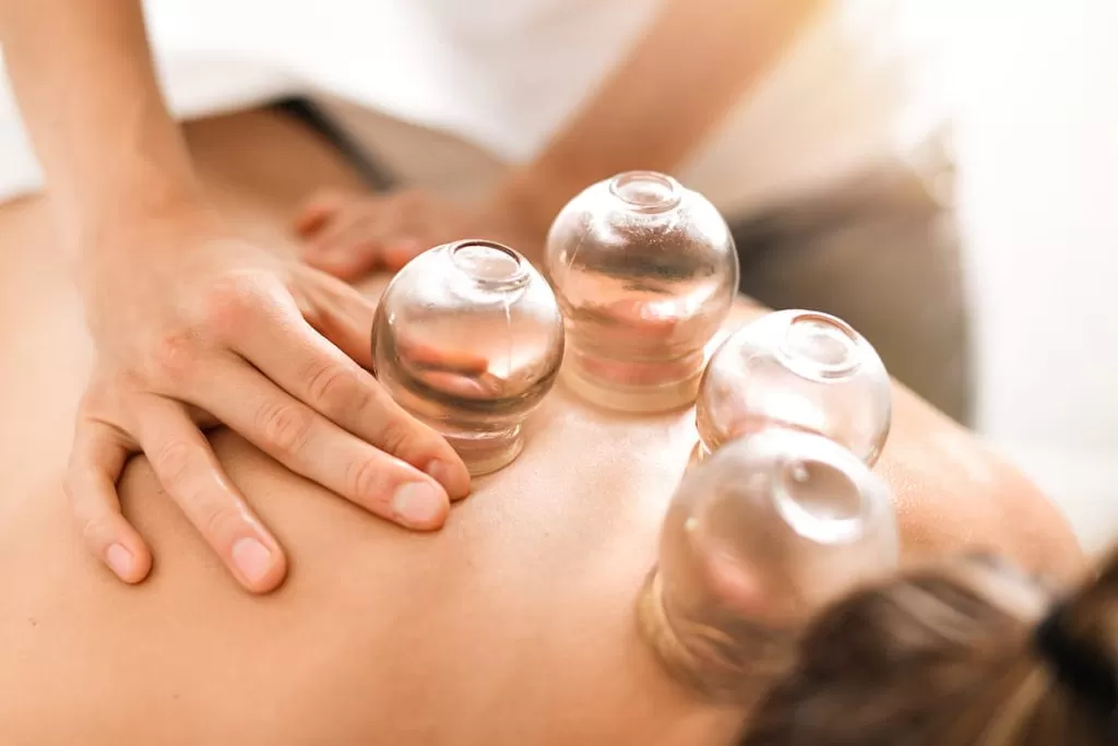 cupping therapy for pain relief