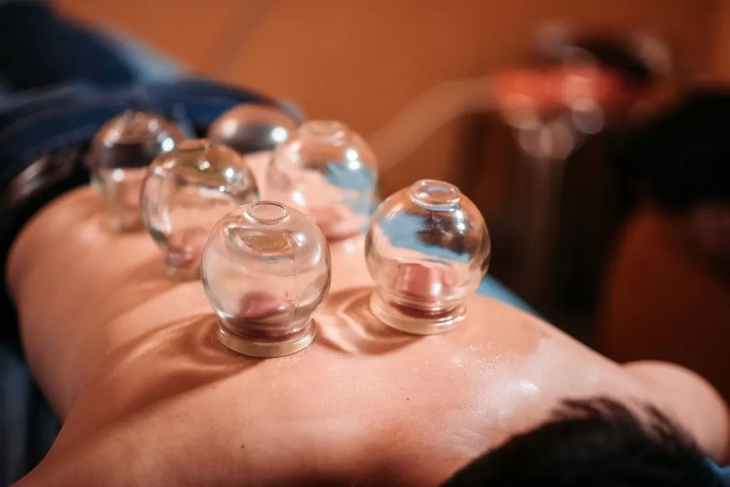 cupping therapy for pain relief in livonia
