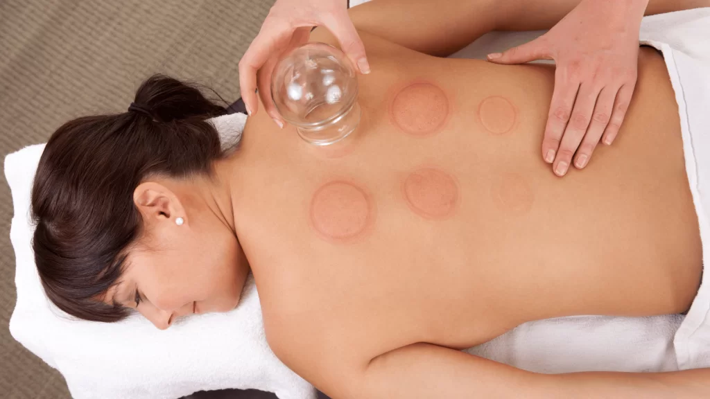 Discover the Art of Cupping Specialist in Brownstown
