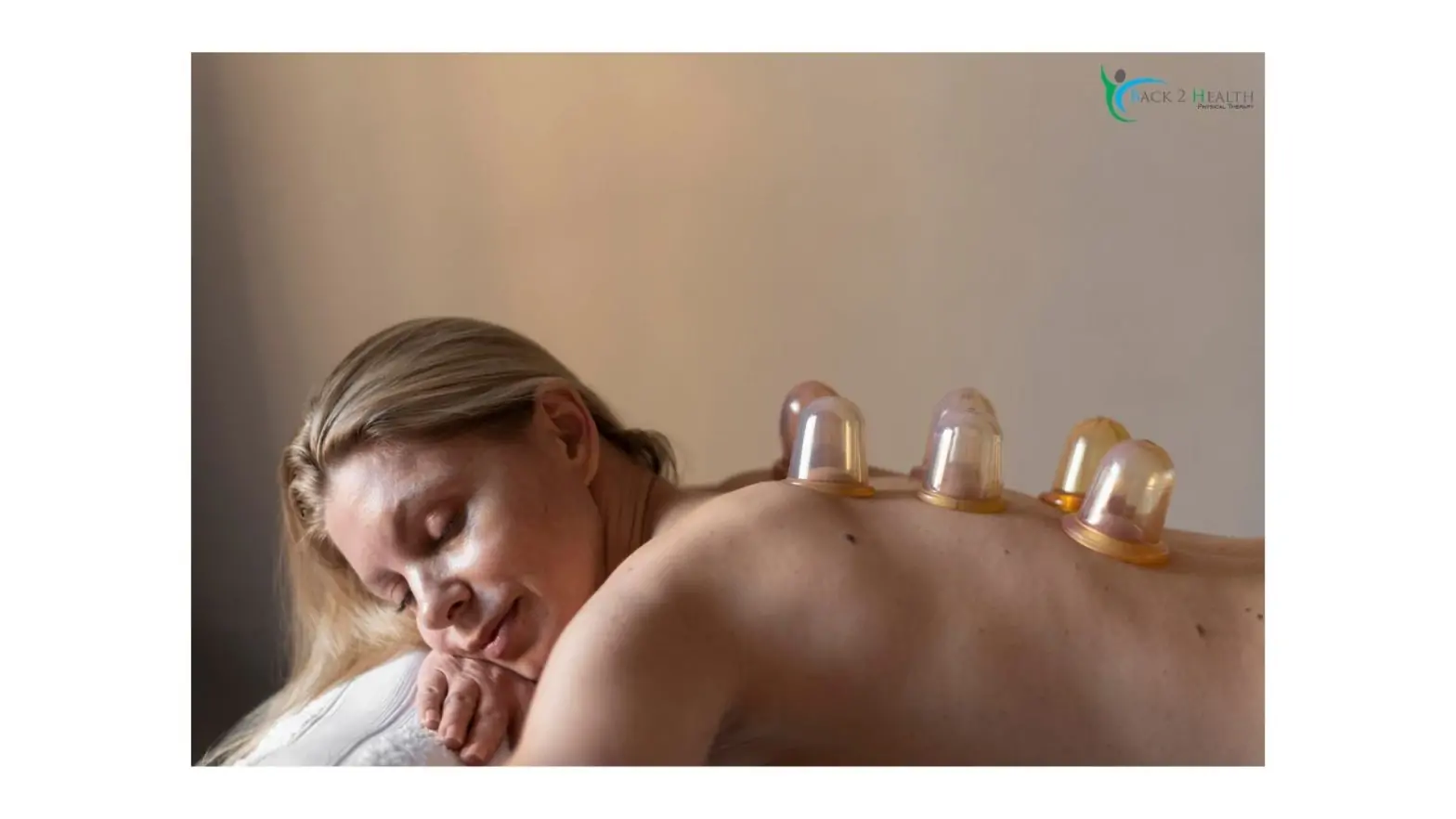 A patient receiving professional myofascial decompression treatment from a cupping specialist Brownstown at Back 2 Health to relieve muscle tension and improve circulation.